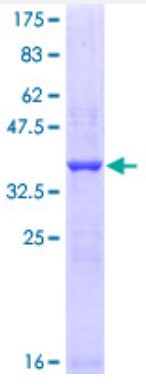 SDS-PAGE (FSHR-4522H).jpg